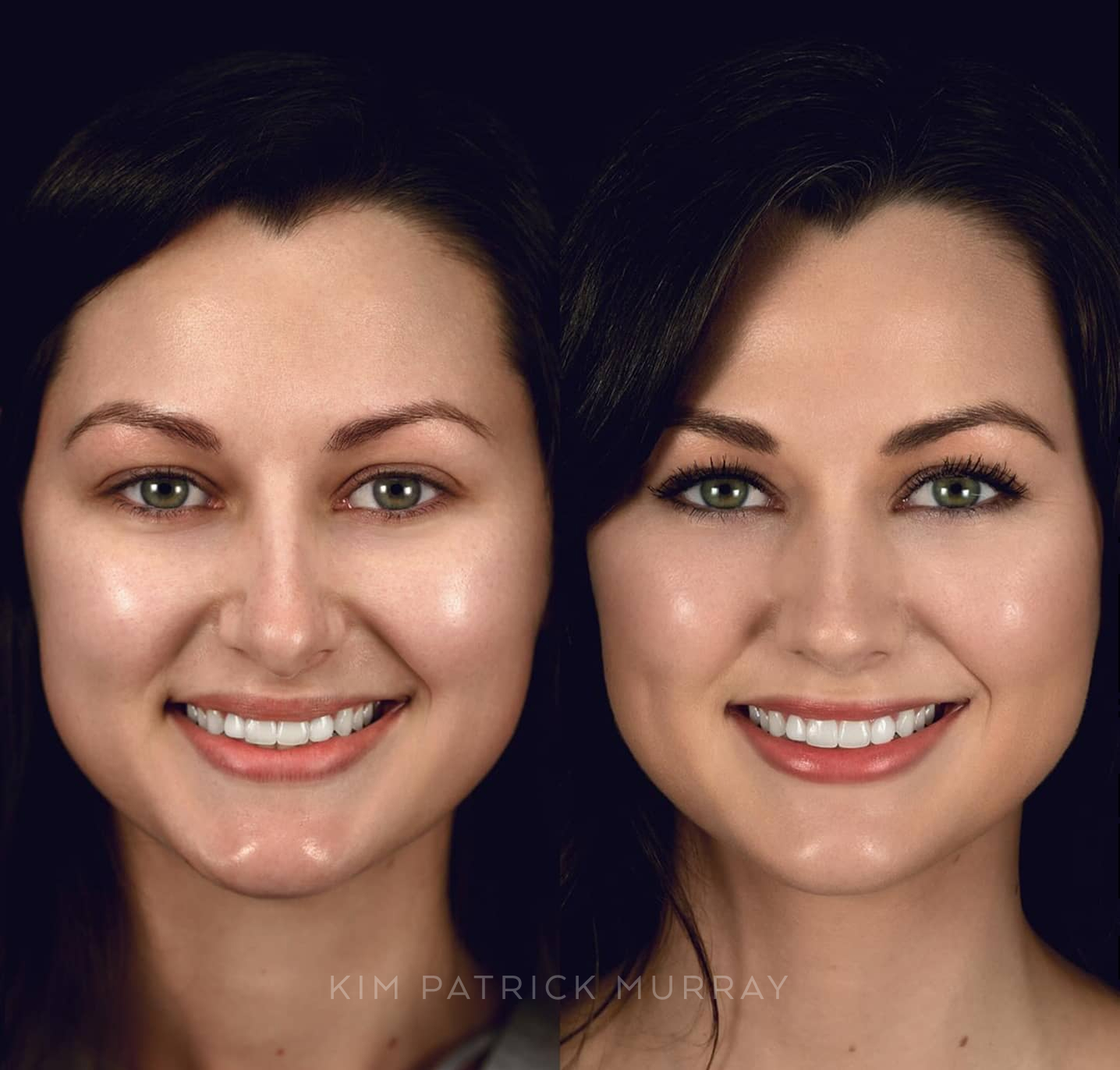 banner-before-after-1