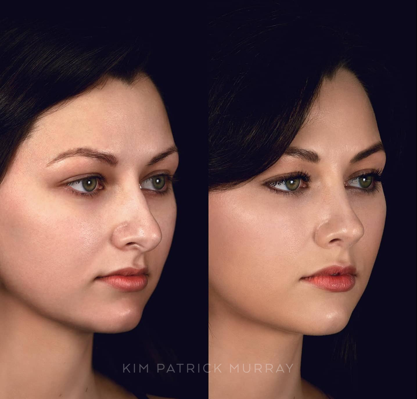 banner-before-after-2