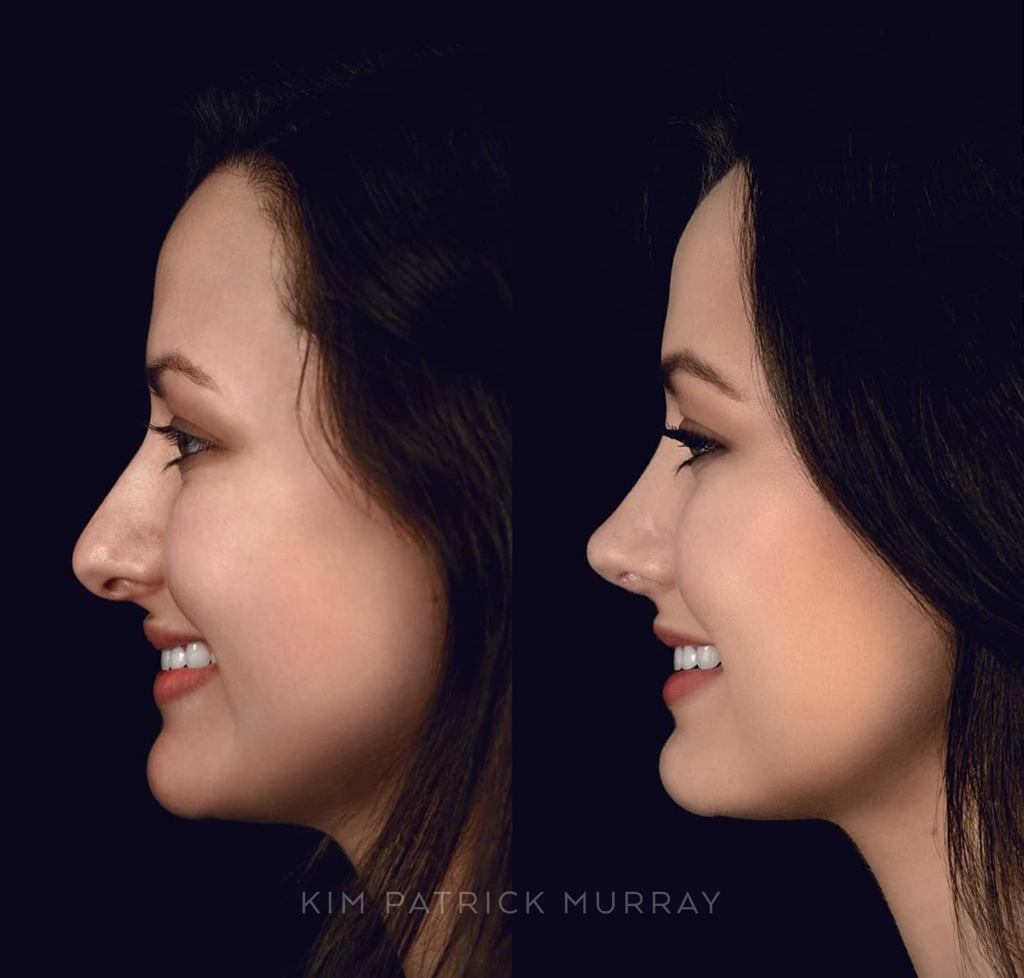 banner-before-after-3