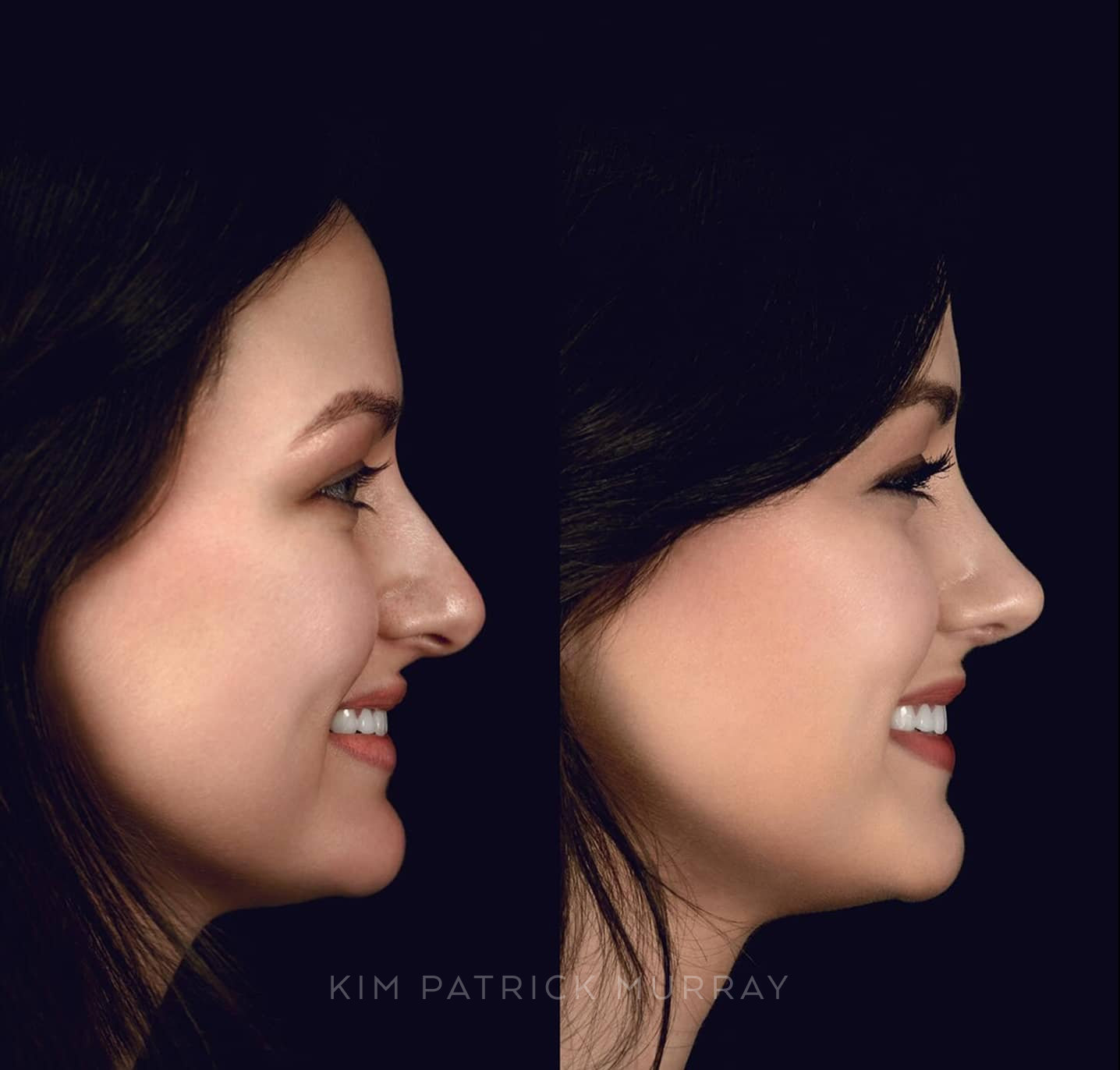 banner-before-after-4