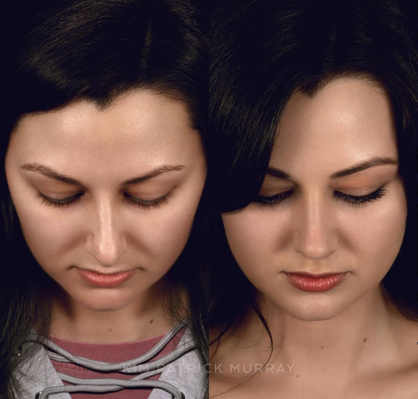 banner-before-after-5