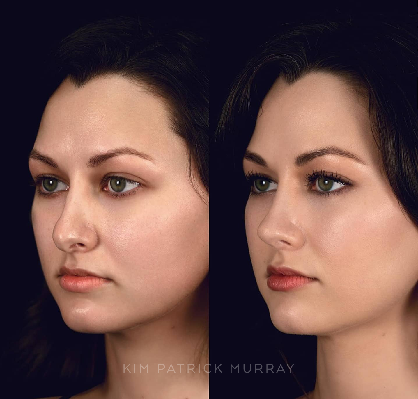 banner-before-after-6